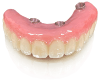 Load image into Gallery viewer, ID GUM FLOW 6ML syringe - Yamahachi Dental Products USA
