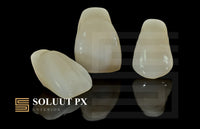 Load image into Gallery viewer, Soluut PX Anterior Teeth Shade W0.5 - Yamahachi Dental Products USA
